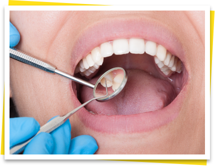 ピンポイントで切削し、なるべく歯を削らない治療