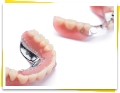 ひとり一人のお口に合わせた、負担のかからない入れ歯作り